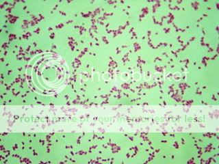 Shigella Dysenteriae Pictures, Images & Photos | Photobucket