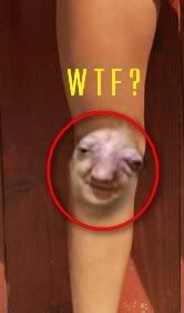 rodilla.jpg